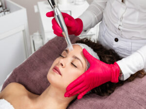microneedling-by-The-Skin-Academy-in-peachtree-city-GA