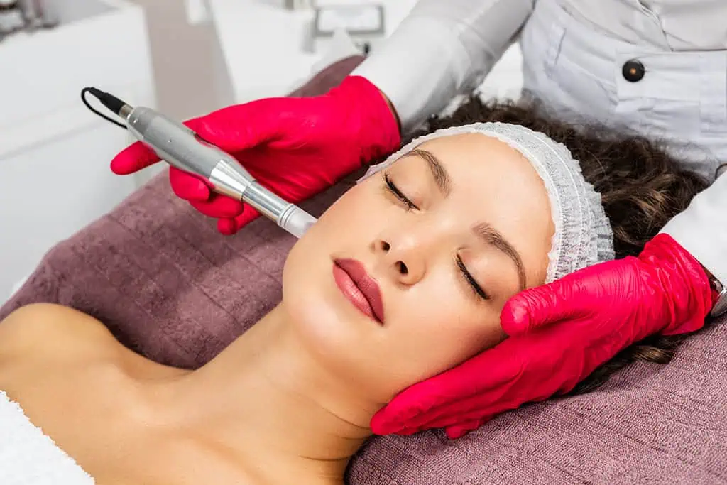 Microneedling in Peachtree City, GA