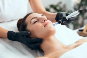 How Microneedling Helps With Hyperpigmentation and Dark Spots